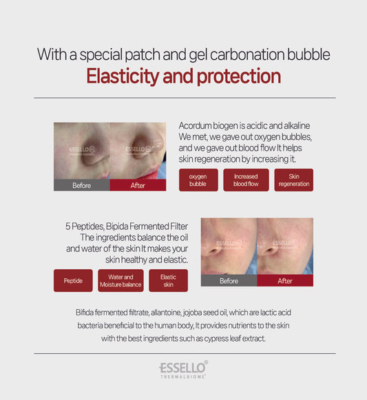 Essello ACODERM Biregen Carboxyl Bifidus  Return Mask Pack