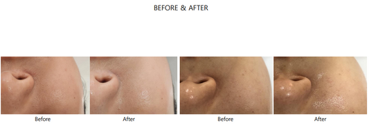 PDRN + Triple Functional Sunblock (SPF50PA++++)