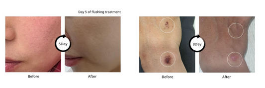 Instant Soothing& Moisturizing Cream